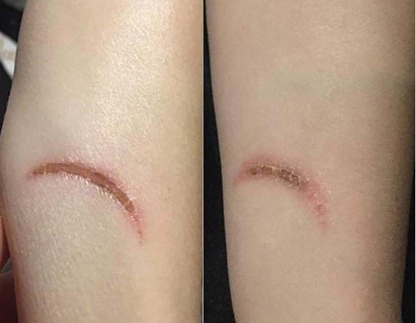 wound healing & pain relief