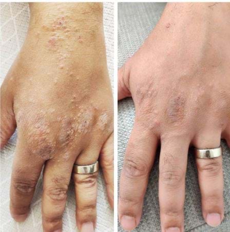 senstive skin conditions